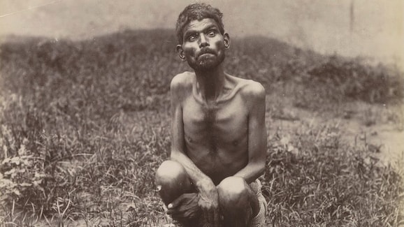 Dina Sanichar Feral Child