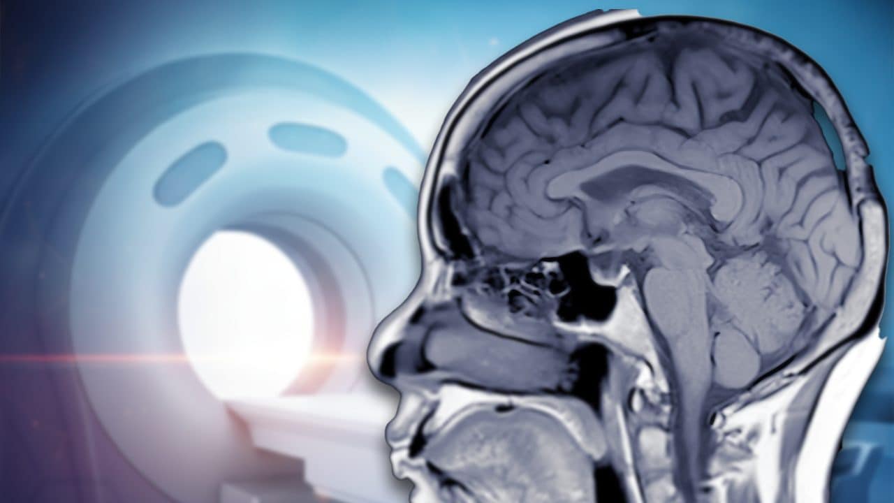 The science of magnetic resonance imaging: how the machine works to produce images of the interior of the body