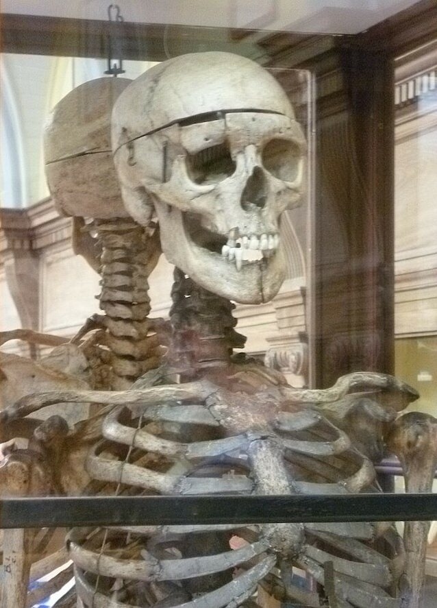 skeleton burke