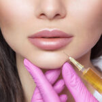 Filler, tossina botulinica e non solo: procedure quasi raddoppiate in un anno