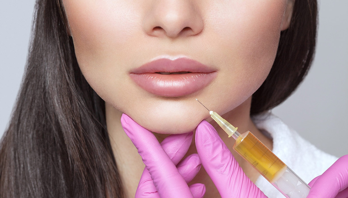 Filler, tossina botulinica e non solo: procedure quasi raddoppiate in un anno