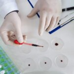 Mieloma multiplo, grazie a GIMEMA parte la nuova rete di laboratori per il controllo della malattia