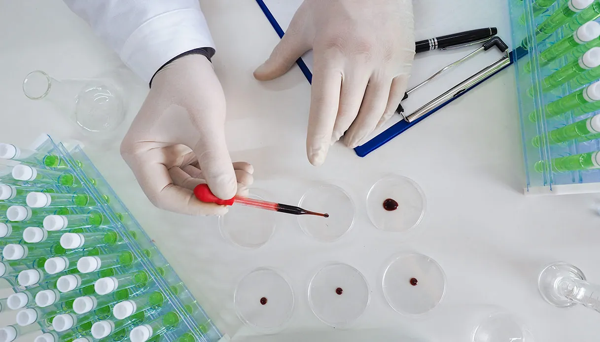 Mieloma multiplo, grazie a GIMEMA parte la nuova rete di laboratori per il controllo della malattia