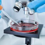 Mielofibrosi e altre malattie mieloproliferative, come si curano: le nuove terapie