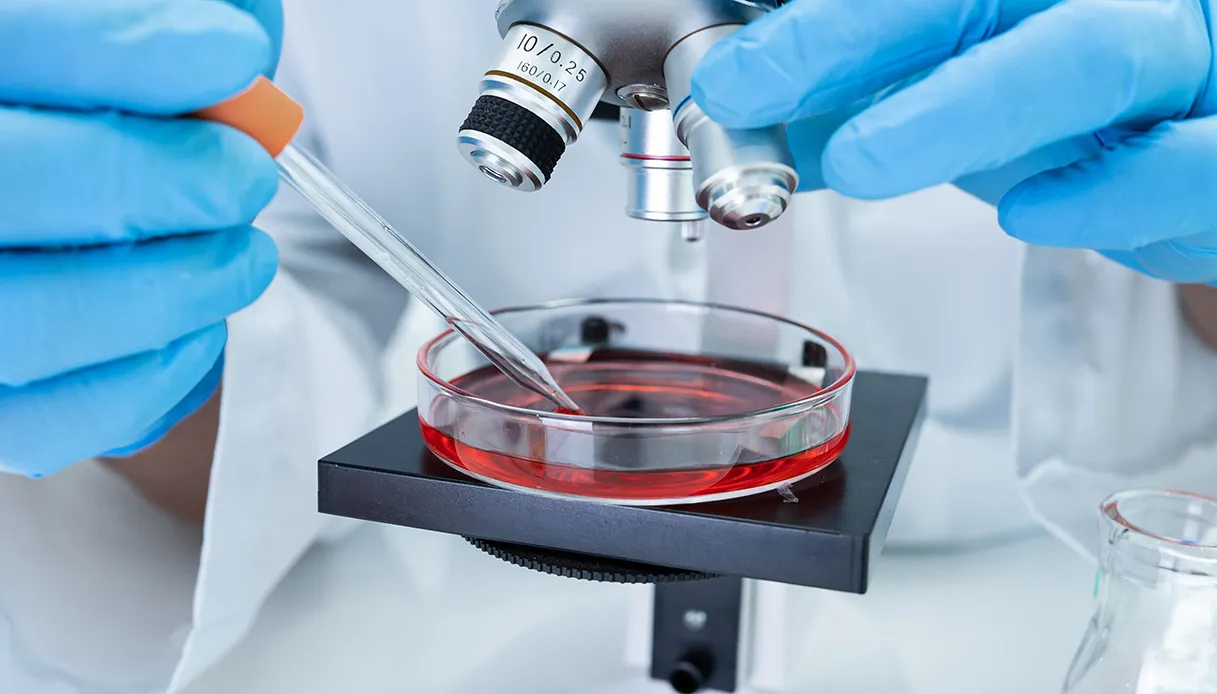 Mielofibrosi e altre malattie mieloproliferative, come si curano: le nuove terapie
