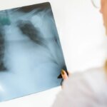 Lista attesa sanità in miglioramento, più prenotazioni: le regioni migliori e peggiori